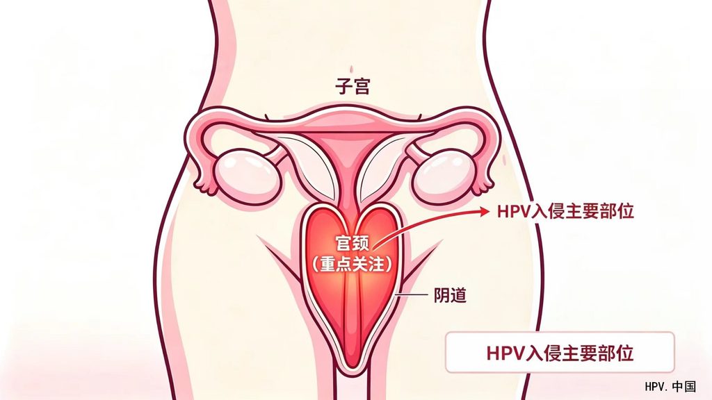 图片[2]-HPV是什么？—— 认识这位宫颈”不速之客”-新凯HPV科普平台